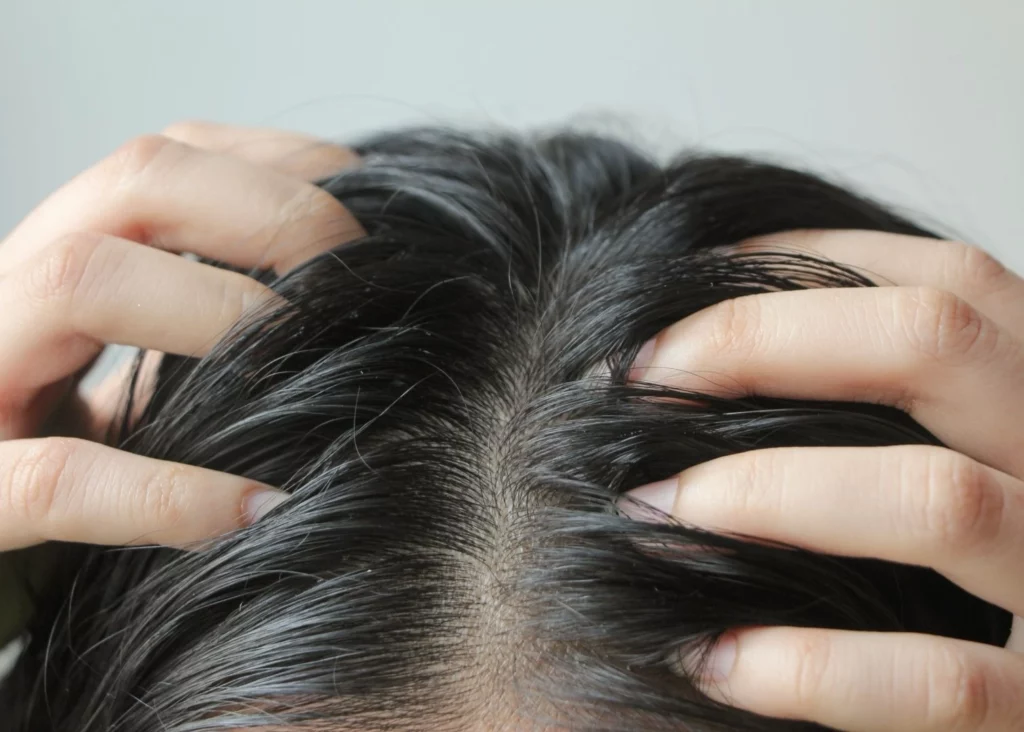 Cheveux gras : comprendre et adopter la routine idéale