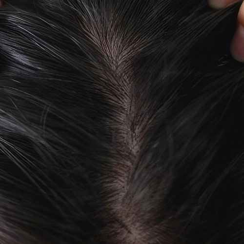 cheveux gras sibel